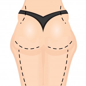 61453309 - liposuction icon